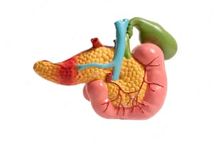 Comment lutter contre le cancer du pancréas avec carcinose péritonéale : utiliser des traitements médicaux et des traitements naturels