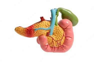 Comment lutter contre le cancer du pancréas avec carcinose péritonéale : utiliser des traitements médicaux et des traitements naturels